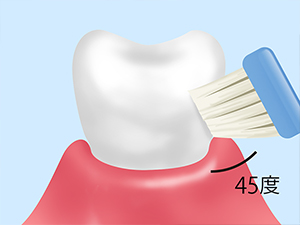 ブラッシング指導